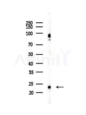 BIK Antibody - Western blot analysis of lysates from COLO205 cells(heat-shock,45min treatment), using BIK Antibody at 1/1000 dilution.