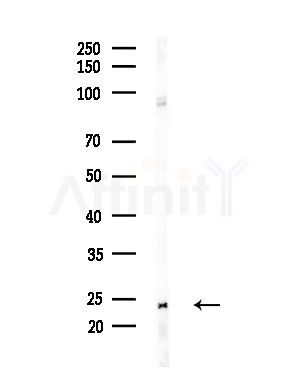 BIK Antibody - Western blot analysis of lysates from Hela cells(heat-shock,45min treatment), using BIK Antibody at 1/1000 dilution.