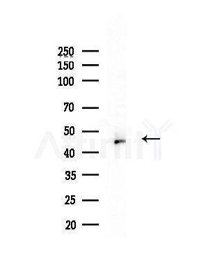 CaMKII beta/ gamma/ delta Antibody - Western blot analysis of lysates from Mouse brain, using CaMKII beta/ gamma/ delta Antibody at 1/1000 dilution.