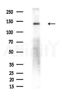 SMC1 Antibody - Western blot analysis of extracts from Mouse testis, using SMC1 Antibody at 1/1000 dilution.
