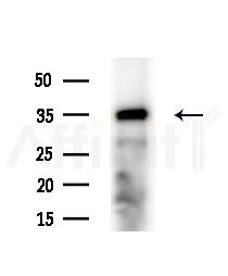IKB beta Antibody - Western blot analysis of extracts from HUVEC cells(starvation,24h treatment), using IKB beta Antibody at 1/1000 dilution.