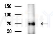 LKB1 Antibody - Western blot analysis of extracts from Rat brain, using LKB1 Antibody at 1/1000 dilution.