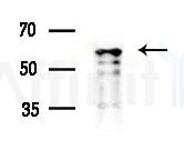 LKB1 Antibody - Western blot analysis of extracts from B16F10-LUC cells
(LPS 4h treatment), using LKB1 Antibody at 1/1000 dilution.