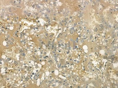 LKB1 Antibody - AF6453 at 1/100 staining human normal lung tissue by IHC-P.
