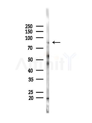 FRS2 Antibody - Western blot analysis of lysates from B16F10-LUC cells(LPS, 4h treatment), using FRS2 Antibody at 1/1000 dilution.
