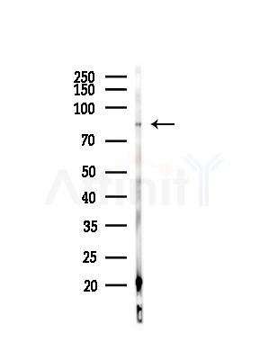 FRS2 Antibody - Western blot analysis of lysates from COS-7 cells(heat-shock,45min treatment), using FRS2 Antibody at 1/1000 dilution.