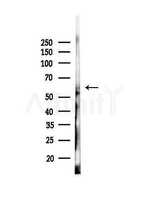p62Dok Antibody - Western blot analysis of lysates from EC304 cells(heat-shock,45min treatment), using p62Dok Antibody at 1/1000 dilution.