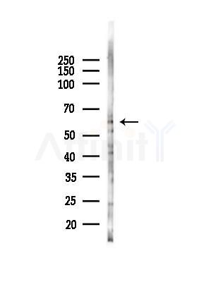 p62Dok Antibody - Western blot analysis of lysates from HepG2 cells(starvation,24h treatment), using p62Dok Antibody at 1/1000 dilution.