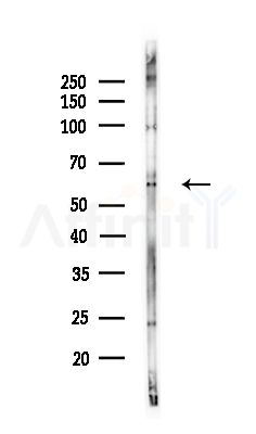 p62Dok Antibody - Western blot analysis of lysates from COLO205 cells(UV,30min treatment), using p62Dok Antibody at 1/1000 dilution.