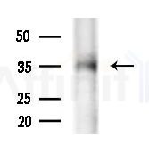 p70 S6 Kinase beta Antibody - Western blot analysis of extracts from Rat liver, using p70 S6 Kinase beta Antibody at 1/1000 dilution.
