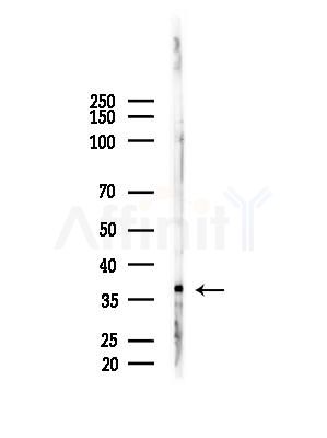 DARPP32 Antibody - Western blot analysis of lysates from HUVEC cells(starvation,24h treatment), using DARPP32 Antibody at 1/1000 dilution.