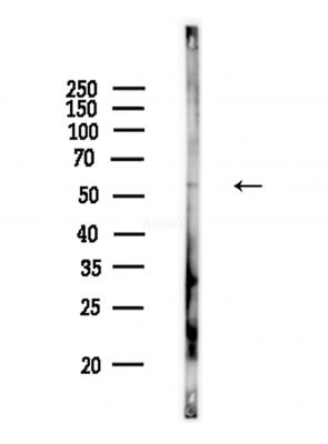 MLKL Antibody - Western blot analysis of lysates from COLO205 cells(heat-shock,45min treatment), using MLKL Antibody at 1/1000 dilution.