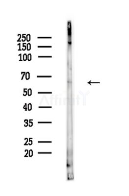 CRTC3 Antibody - Western blot analysis of lysates from Hela cells(LPS,4h treatment), using CRTC3 Antibody at 1/1000 dilution.