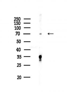 TORC2 Antibody - Western blot analysis of lysates from COLO205 cells(heat-shock,45min treatment), using TORC2 Antibody at 1/1000 dilution.