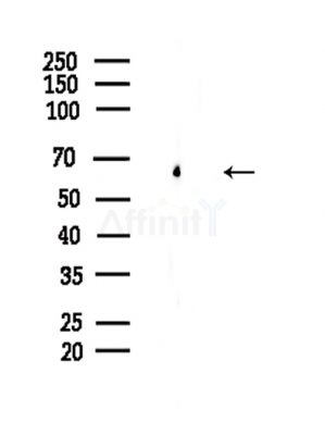 TORC2 Antibody - Western blot analysis of lysates from Hela cells(LPS,4h treatment), using TORC2 Antibody at 1/1000 dilution.