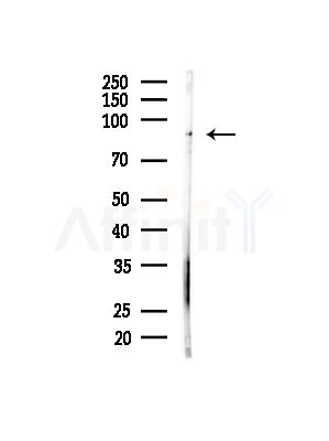 FGFR1/2 Antibody - Western blot analysis of lysates from HUVEC cells(starvation,24h treatment), using FGFR1/2 Antibody at 1/1000 dilution.