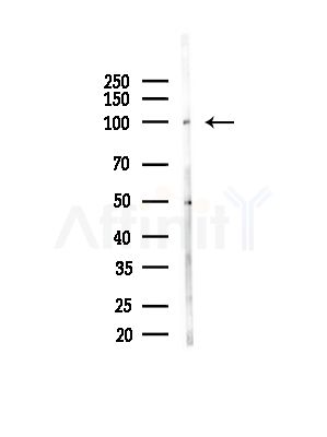 LETM1 Antibody - Western blot analysis of lysates from B16F10-LUC cells(starvation,24h treatment), using LETM1 Antibody at 1/1000 dilution.