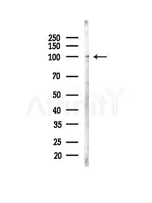 ACTN1/2/3/4 Antibody - Western blot analysis of lysates from B16F10-LUC cells(starvation,24h treatment), using ACTN1/2/3/4 Antibody at 1/1000 dilution.