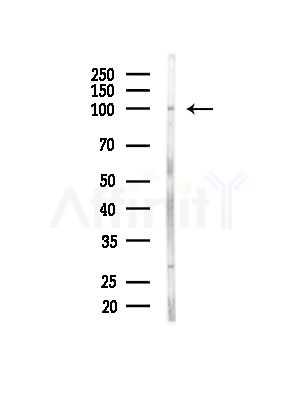 ACTN1/2/3/4 Antibody - Western blot analysis of lysates from HUVEC cells(starvation,24h treatment), using ACTN1/2/3/4 Antibody at 1/1000 dilution.