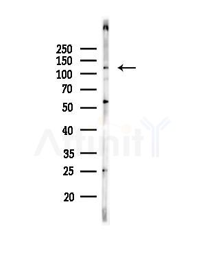 Bub1 Antibody - Western blot analysis of lysates from PC12 cells(heat-shock,45min treatment), using Bub1 Antibody at 1/1000 dilution.