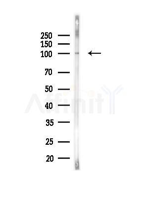 TIF1 alpha Antibody - Western blot analysis of lysates from PC12 cells(heat-shock,45min treatment), using TIF1 alpha Antibody at 1/1000 dilution.