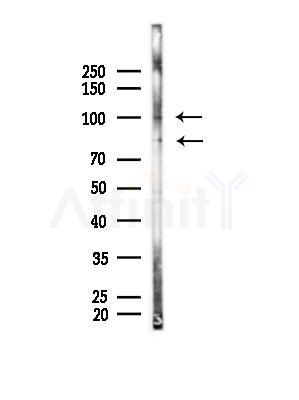 TIF1 alpha Antibody - Western blot analysis of lysates from MCF7 cells(heat-shock,45min treatment), using TIF1 alpha Antibody at 1/1000 dilution.