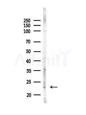 RAB7L1 Antibody - Western blot analysis of lysates from PC12 cells(heat-shock,45min treatment), using RAB7L1 Antibody at 1/1000 dilution.