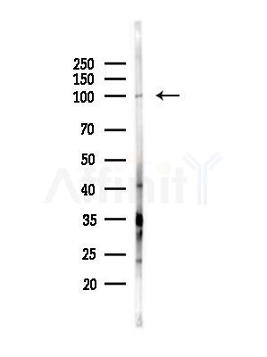 eEF2K Antibody - Western blot analysis of lysates from PC12 cells(heat-shock,45min treatment), using eEF2K Antibody at 1/1000 dilution.