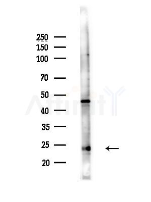TIMP2 Antibody - Western blot analysis of lysates from Hela cells(heat-shock,45min treatment), using TIMP2 Antibody at 1/1000 dilution.