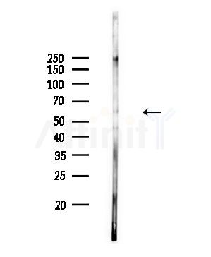 TFEB Antibody - Western blot analysis of lysates from Rat brain, using TFEB Antibody at 1/1000 dilution.