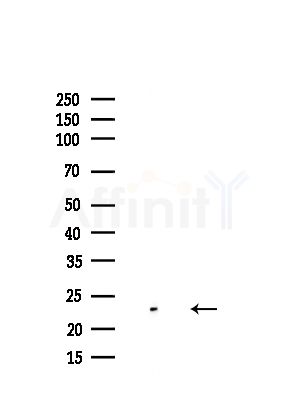VEGFB Antibody - Western blot analysis of lysates from HUVEC cells(starvation,24h treatment), using VEGFB Antibody at 1/1000 dilution.