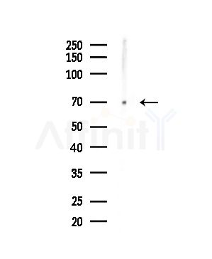 Cleaved-PARP (Asp214) Antibody - Western blot analysis of lysates from Hela cells(LPS,4h treatment), using Cleaved-PARP (Asp214) Antibody at 1/1000 dilution.