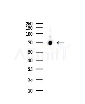 Cleaved-PARP (Asp214) Antibody - Western blot analysis of lysates from Mouse lung, using Cleaved-PARP (Asp214) Antibody at 1/1000 dilution.