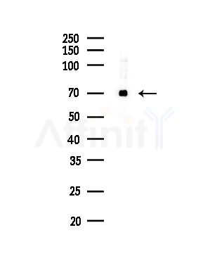 Cleaved-PARP (Asp214) Antibody - Western blot analysis of lysates from Rat liver, using Cleaved-PARP (Asp214) Antibody at 1/1000 dilution.