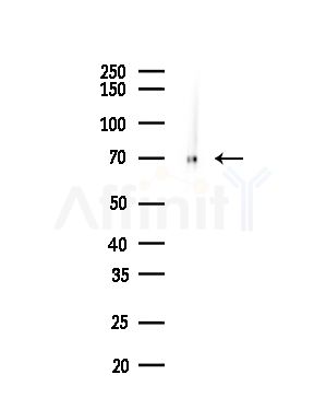 Cleaved-PARP (Asp214) Antibody - Western blot analysis of lysates from COLO205 cells(heat-shock,45min treatment), using Cleaved-PARP (Asp214) Antibody at 1/1000 dilution.