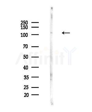 INCENP Antibody - Western blot analysis of lysates from LoVo cells(heat-shock,45min treatment), using INCENP Antibody at 1/1000 dilution.
