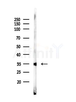 PRPS1 Antibody - Western blot analysis of lysates from A375 cells(LPS, 4h treatment), using PRPS1 Antibody at 1/1000 dilution.