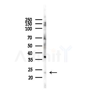 Phospho-Skp1 (Thr131) Antibody - Western blot analysis of lysates from COLO205 cells(heat-shock,45min treatment), using Phospho-Skp1 (Thr131) Antibody at 1/1000 dilution.