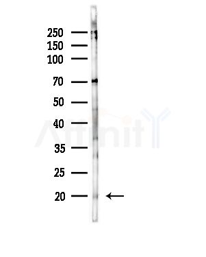 Phospho-Skp1 (Thr131) Antibody - Western blot analysis of lysates from RAW264.