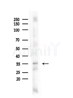 Phospho-CDK20 (Thr161) Antibody - Western blot analysis of lysates from COLO205 cells(heat-shock,45min treatment), using Phospho-CDK20 (Thr161) Antibody at 1/1000 dilution.