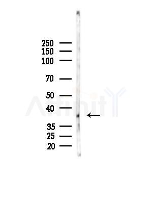 Phospho-CTGF (Ser118) Antibody - Western blot analysis of lysates from 293 cells(UV,30min treatment), using Phospho-CTGF (Ser118) Antibody at 1/1000 dilution.