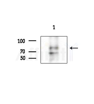 Phospho-KCNH2 (Ser1137) Antibody - Western blot analysis of extracts from 293 cells(UV treatment), using Phospho-KCNH2 (Ser1137) Antibody at 1/1000 dilution.