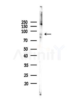 Phospho-KCNH2 (Ser1137) Antibody - Western blot analysis of lysates from 293 cells(UV,30min treatment), using Phospho-KCNH2 (Ser1137) Antibody at 1/1000 dilution.