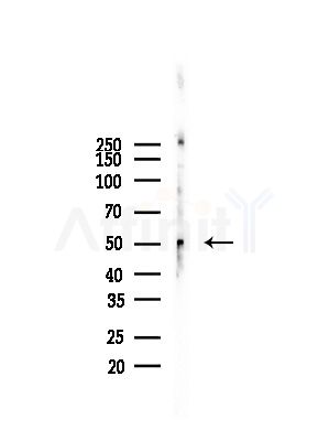 Phospho-KLF5 (Ser303) Antibody - Western blot analysis of lysates from Hela cells(heat-shock, 45min treatment), using Phospho-KLF5 (Ser303) Antibody at 1/1000 dilution.