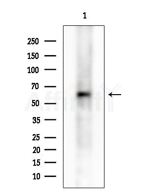 Phospho-SLC16A1 (Ser213) Antibody - Western blot analysis of extracts from Rat testis, using Phospho-SLC16A1 (Ser213) Antibody at 1/1000 dilution.