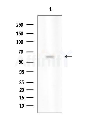 Phospho-TRAF7 (Ser61) Antibody - Western blot analysis of extracts from HUVEC cells, using Phospho-TRAF7 (Ser61) Antibody at 1/1000 dilution.