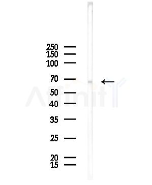 Phospho-TRAF7 (Ser61) Antibody - Western blot analysis of lysates from HUVEC cells, using Phospho-TRAF7 (Ser61) Antibody at 1/1000 dilution.
