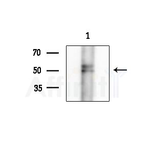 Phospho-TTF1 (Ser23) Antibody - Western blot analysis of extracts from Hela cells(starvation treatment), using Phospho-TTF1 (Ser23) Antibody at 1/1000 dilution.