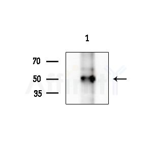 Phospho-TTF1 (Ser23) Antibody - Western blot analysis of extracts from 293 cells(UV treatment), using Phospho-TTF1 (Ser23) Antibody at 1/1000 dilution.