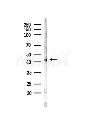 Phospho-TTF1 (Ser23) Antibody - Western blot analysis of lysates from 293 cells(UV,30min treatment), using Phospho-TTF1 (Ser23) Antibody at 1/1000 dilution.